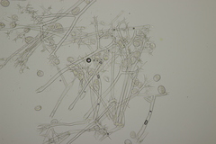 Plasmopara angelicae