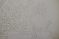 Plasmopara angelicae