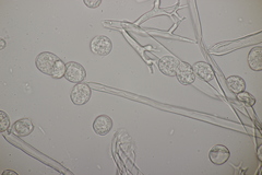 Plasmopara angelicae