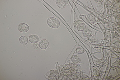 Plasmopara angelicae