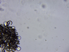 Dolichospermum lemmermannii