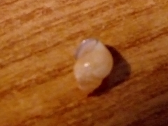 Bithynia tentaculata