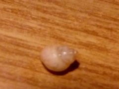 Bithynia tentaculata