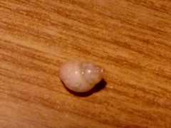 Bithynia tentaculata