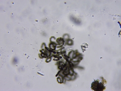 Dolichospermum lemmermannii