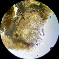 Pertusaria consocians