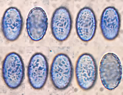 Scutellinia olivascens