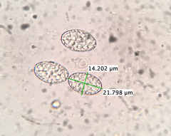 Scutellinia olivascens