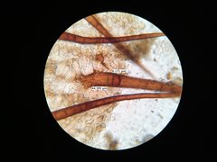 Scutellinia olivascens
