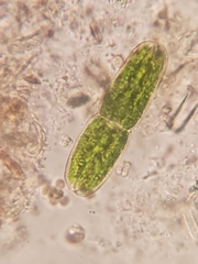 Tetmemorus brebissonii