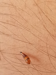 Tachyporus abdominalis