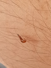 Tachyporus abdominalis