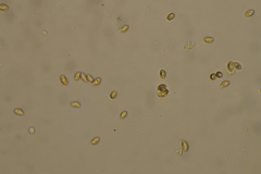 Glaucopodes