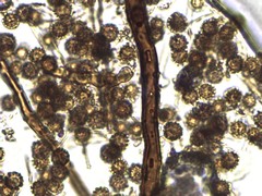 Lycoperdon mammiforme