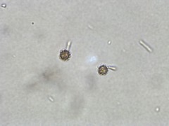 Lycoperdon mammiforme