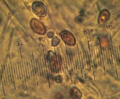 Glaucopodes