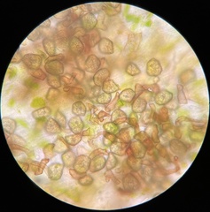 Phaeoceros carolinianus