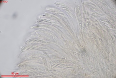 Hymenoscyphus scutula