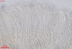 Hymenoscyphus scutula