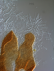 Nectriopsis oropensoides