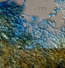 Nectriopsis oropensoides