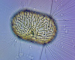Corethron