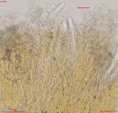 Parachnopeziza miniopsis