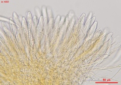 Parachnopeziza miniopsis