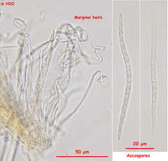 Parachnopeziza miniopsis