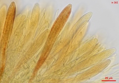 Parachnopeziza miniopsis