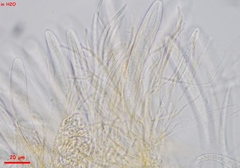 Parachnopeziza miniopsis