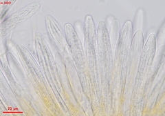 Parachnopeziza miniopsis