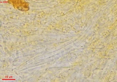 Parachnopeziza miniopsis