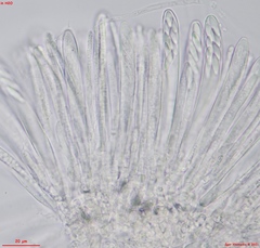 Hymenoscyphus immutabilis