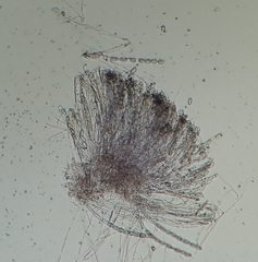 Pezicula cinnamomea