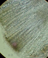 Pezicula cinnamomea