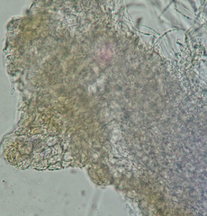 Pezicula cinnamomea