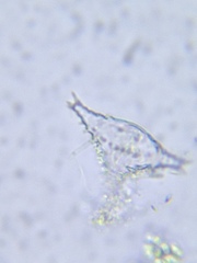 Staurastrum anatinum