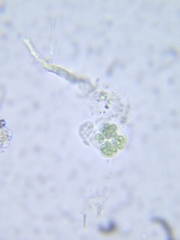 Sphaerocystis