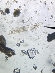 Protozoa