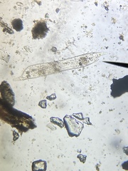 Protozoa