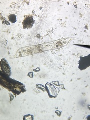Protozoa