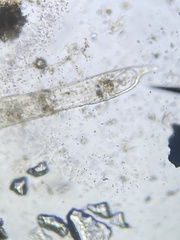 Protozoa