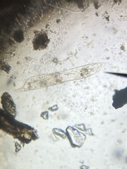 Protozoa