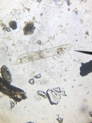 Protozoa