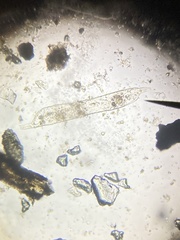 Protozoa