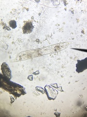Protozoa