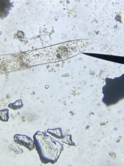 Protozoa