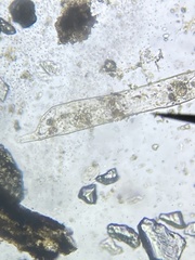Protozoa