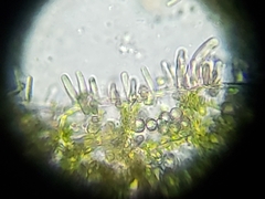 Clasmatocolea vermicularis
